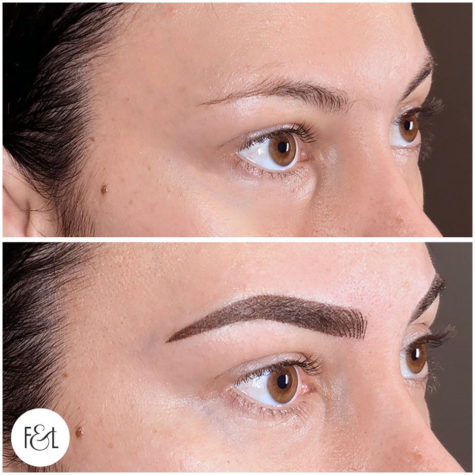 chloe before and after brows