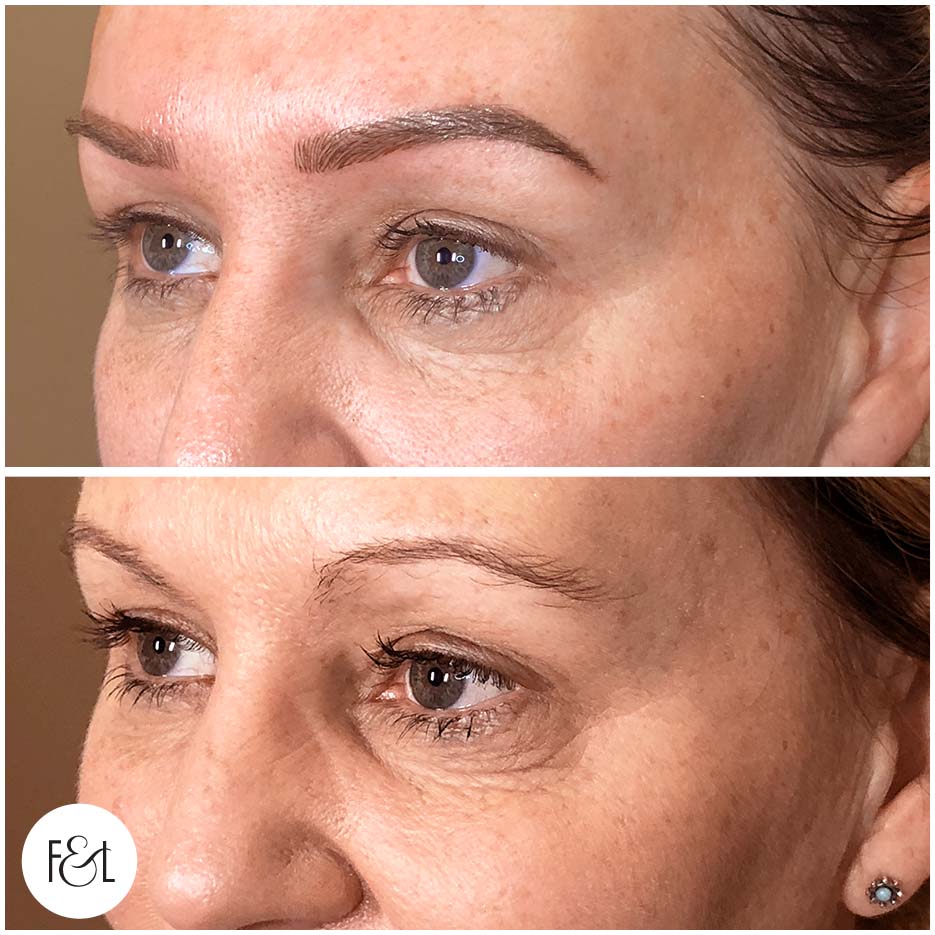 cindy before and after brows