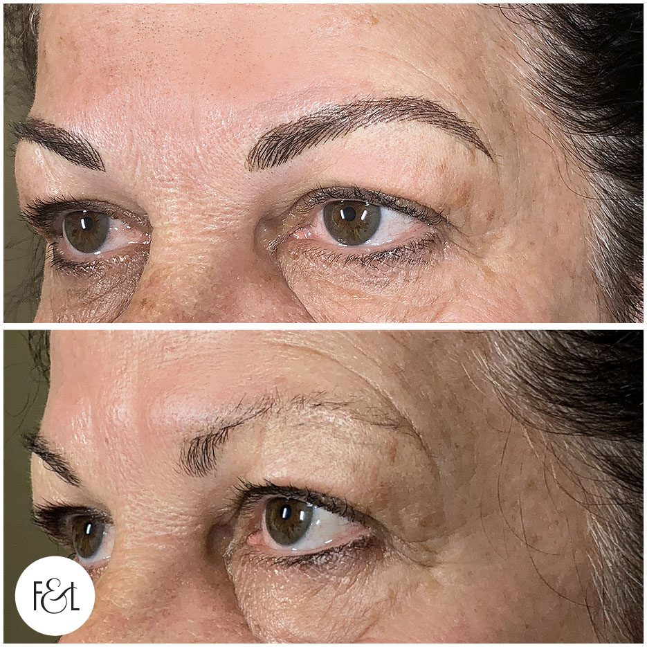 cheryl before and after brows